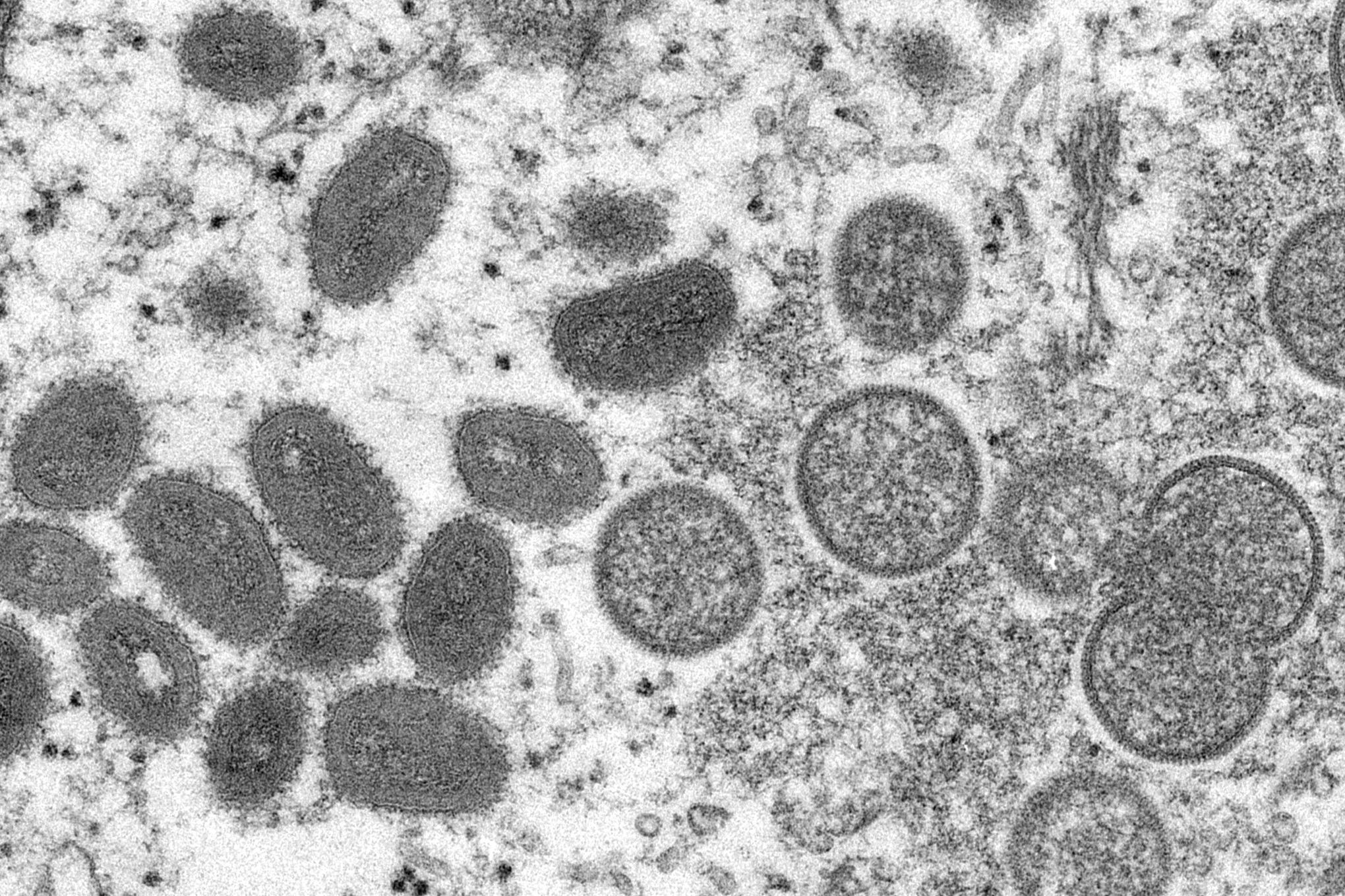 This electron microscope image shows mature, oval-shaped monkeypox virions, left, and spherical immature virions, right.