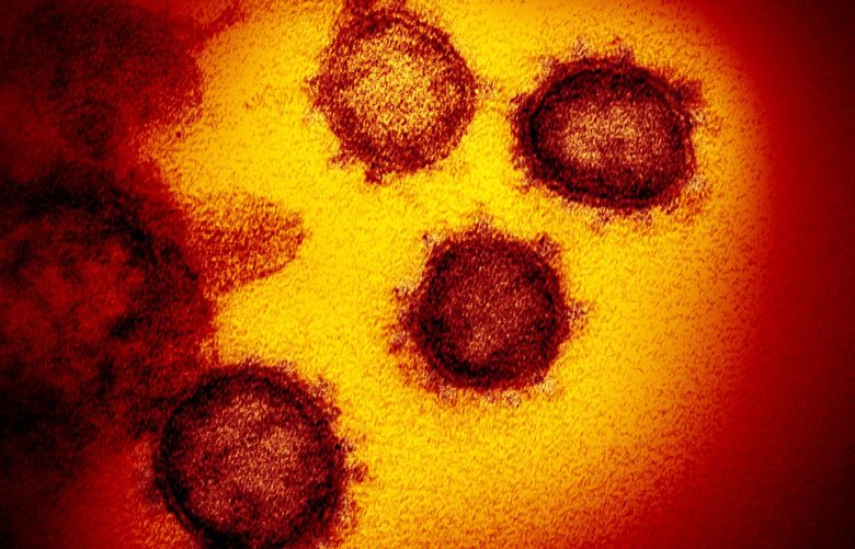 An image from an electron microscope shows SARS-CoV-2, the virus that causes COVID-19. Higher viral load is more deadly for COVID-19 hospital patients, UW analysis finds. (NIAID-RML/Zuma Press/TNS) 48866264W 48866264W