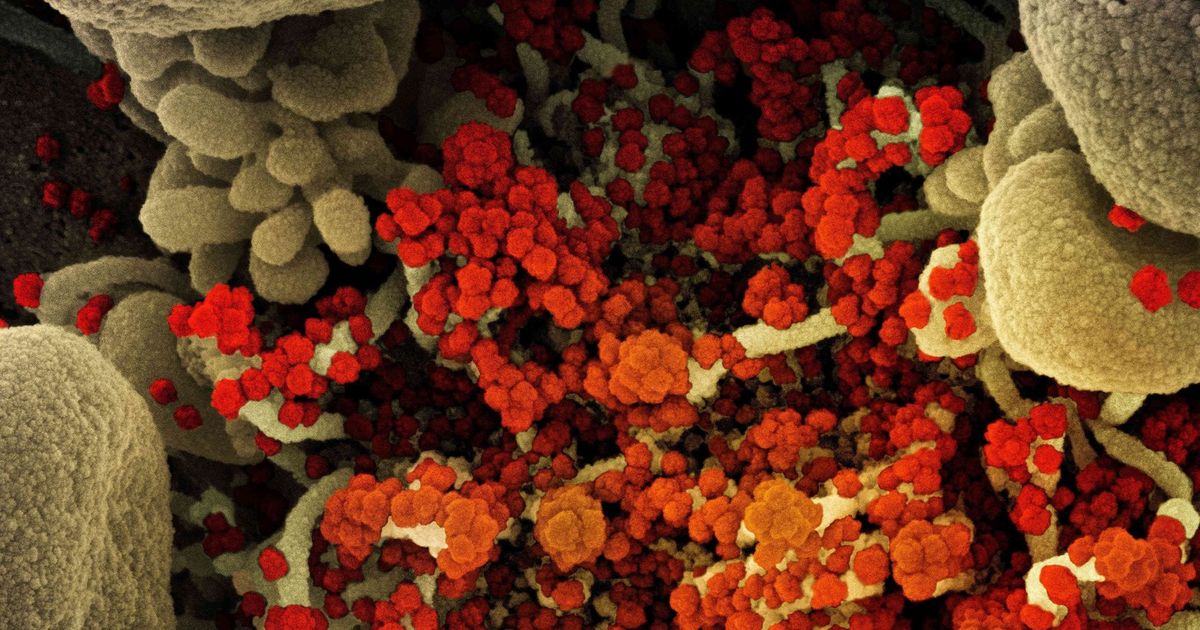 Researchers find that 2 drugs reduced COVID deaths
