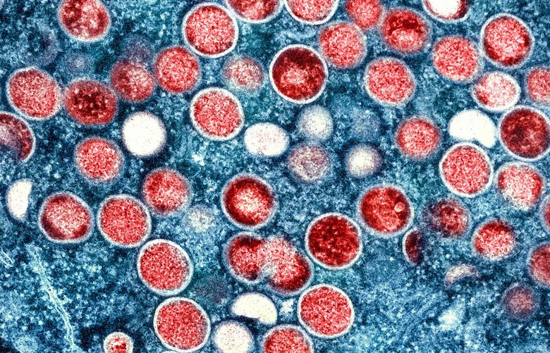 Colorized transmission electron micrograph of monkeypox virus particles (red) cultivated and purified from cell culture. Image captured at the NIAID Integrated Research Facility (IRF) in Fort Detrick, Maryland.