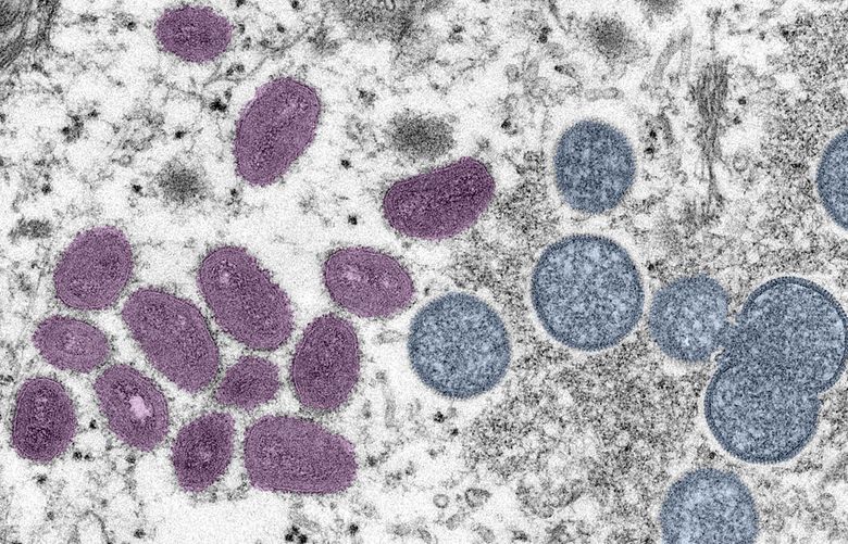 This digitally-colorized electron microscopic (EM) image depicted monkeypox virus particles, obtained from a clinical sample associated with the 2003 prairie dog outbreak. It was a thin section image from of a human skin sample. On the left were mature, oval-shaped virus particles, and on the right were the crescents, and spherical particles of immature virions. (Cynthia S. Goldsmith, Russell Regnery / CDC)