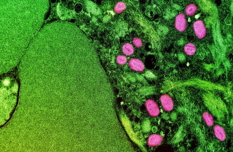 A colorized transmission electron micrograph of monkeypox particles (pink) found within an infected cell (green), cultured in the laboratory. The image was captured at the National Institute of Allergy and Infectious Diseases Integrated Research Facility in Fort Detrick, Maryland. (National Institute of Allergy and Infectious Diseases)