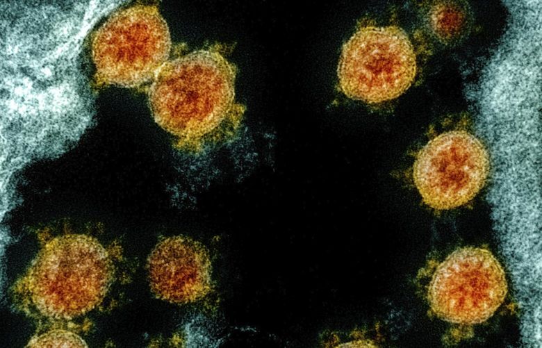This electron microscope image made available and color-enhanced by the National Institute of Allergy and Infectious Diseases Integrated Research Facility in Fort Detrick, Md., shows Novel Coronavirus SARS-CoV-2 virus particles, orange, isolated from a patient. (Courtesy of NIAID/National Institutes of Health via The Associated Press)