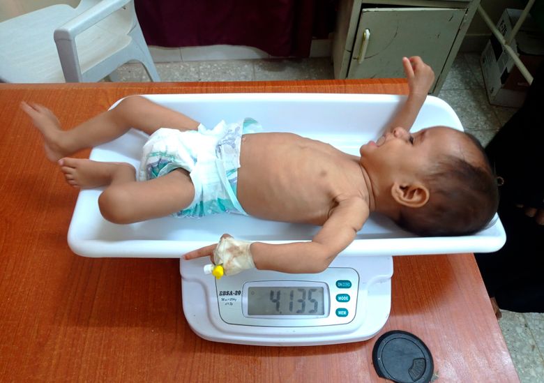 Newborn baby on weight scale in hospital Stock Photo