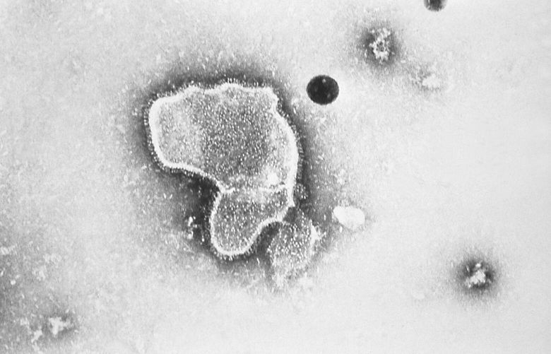 FILE – This 1981 photo provided by the Centers for Disease Control and Prevention (CDC) shows an electron micrograph of Respiratory Syncytial Virus, also known as RSV.  New research announced by Pfizer on Tuesday, Nov. 1, 2022, showed vaccinating pregnant women helped protect their newborns from the common but scary respiratory virus that fills hospitals with wheezing babies each fall.  (CDC via AP, File) NYCD301 NYCD301