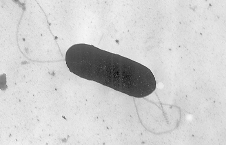 FILE – This 2002 electron microscope image made available by the Centers for Disease Control and Prevention shows a Listeria monocytogenes bacterium, responsible for the food borne illness listeriosis. On Wednesday, Nov. 9, 2022, U.S. health officials said at least one death and a pregnancy loss are tied to an outbreak of listeria food poisoning associated with sliced deli meats and cheeses that has sickened 16 people in six states, including 13 who were hospitalized. (Elizabeth White/CDC via AP, File) NY749 NY749