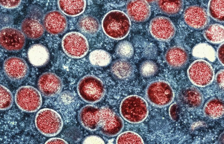FILE – This image provided by the National Institute of Allergy and Infectious Diseases (NIAID) shows a colorized transmission electron micrograph of monkeypox particles (red) found within an infected cell (blue), cultured in the laboratory that was captured and color-enhanced at the NIAID Integrated Research Facility (IRF) in Fort Detrick, Md. The World Health Organization has renamed monkeypox as mpox, citing concerns the original name of the decades-old animal disease could be construed as discriminatory and racist. (NIAID via AP, File) AMB102 AMB102