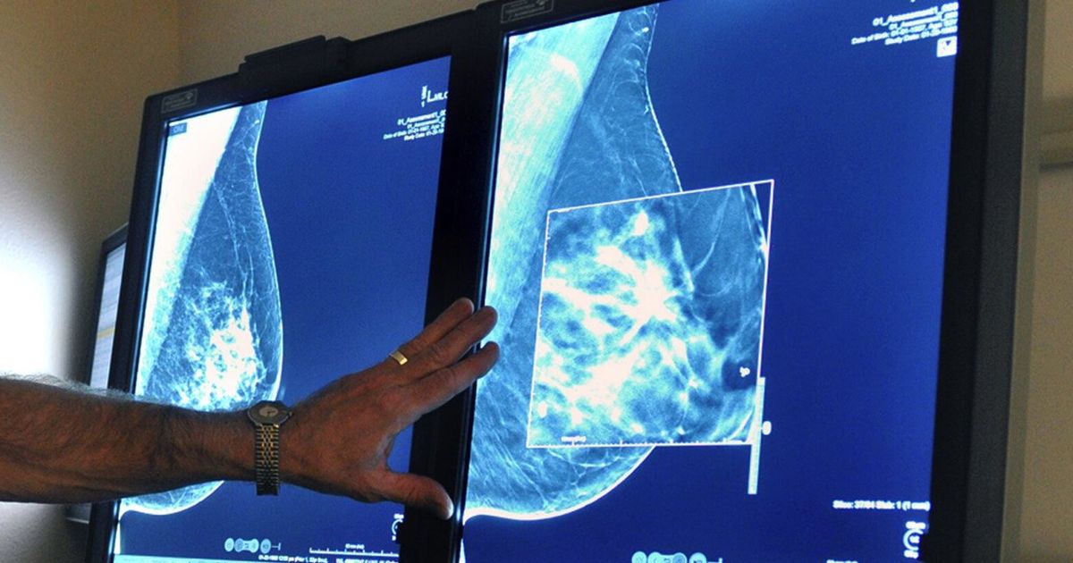 The Alarming Rise of Cancer in Young Women: A Growing Health Concern