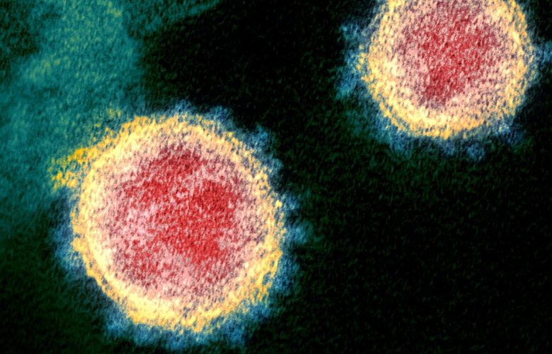 This undated electron microscope image made available by the U.S. National Institutes of Health in February 2020 shows the Novel Coronavirus SARS-CoV-2. Also known as 2019-nCoV, the virus causes COVID-19. The sample was isolated from a patient in the U.S. (NIAID-RML via AP) ny401 ny401 ny401