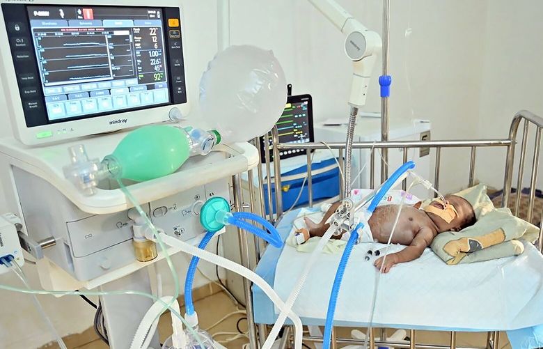 A photo provided by the Sudanese American Physicians Association shows a day-old child being treated for severe Respiratory Distress Syndrome at Al-Nada, a hospital in Omdurman, Sudan, just north of the capital of Khartoum. War in the northeast African nation has forced pregnant women to drive “through hell” to reach the dwindling number of hospitals and clinics, or turn to overworked midwives to give birth at home. (Omer Jay/Sudanese American Physician Association via The New York Times) — NO SALES; FOR EDITORIAL USE ONLY WITH NYT STORY SLUGGED ????? ????? BY CORA ENGELBRECHT and ABDI LATIF DAHIR FOR MAY 23, 2023. ALL OTHER USE PROHIBITED. — XNYT0912