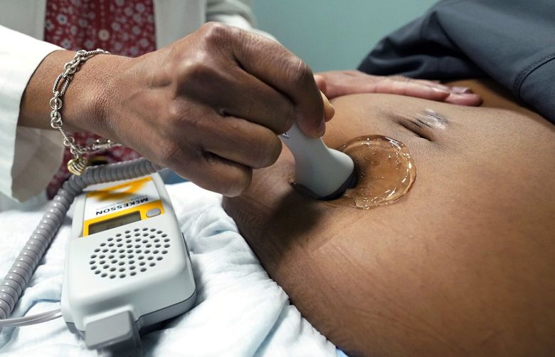 FILE – A doctor uses a hand-held Doppler probe on a pregnant woman to measure the heartbeat of the fetus on Dec. 17, 2021, in Jackson, Miss. U.S. births were flat in 2022, as the nation continues to see fewer babies born than before the pandemic. (AP Photo/Rogelio V. Solis, File) NY869 NY869