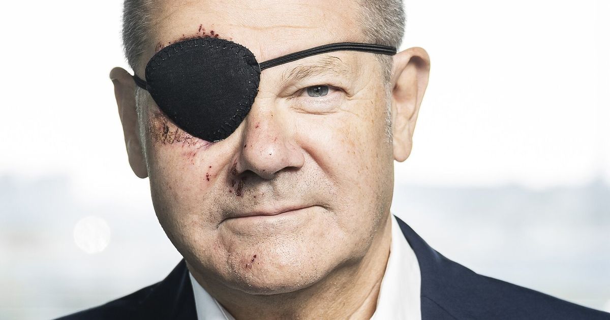 German Chancellor Scholz tweets picture of himself with black eye patch ...