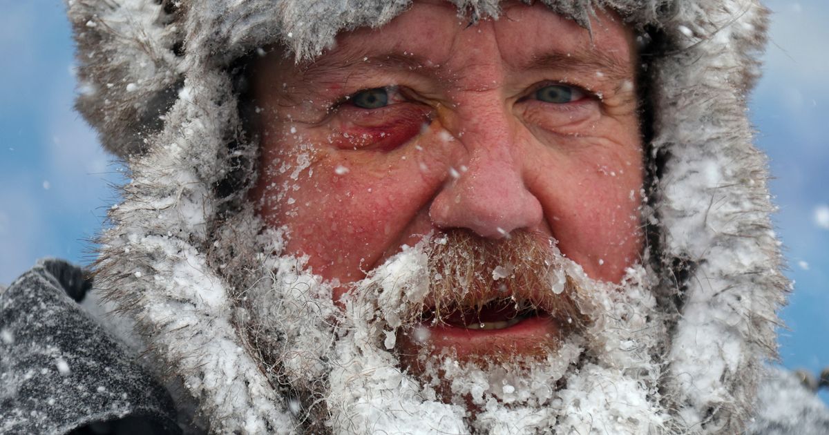 US in deep freeze while much of the world is extra toasty? Yet again
