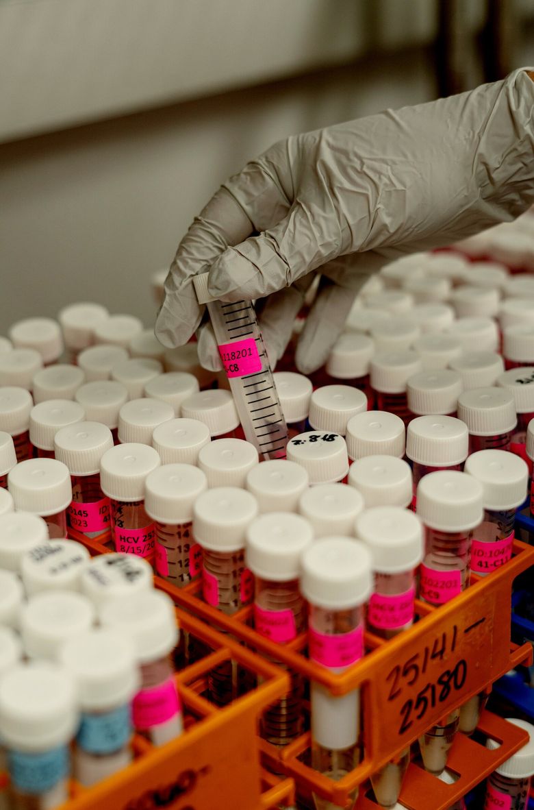 FILE – COVID-19 test swabs in a lab at the University of Michigan in Ann Arbor, Oct. 10, 2023. Scientists studying the COVID-19’s continuing evolution, and the body’s immune responses to the virus, hope they can head off a resurgence and also better understand long Covid. (Cydni Elledge/The New York Times)