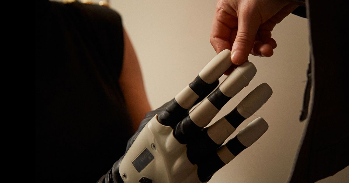 She learned how to use a new prosthetic limb that learned from her