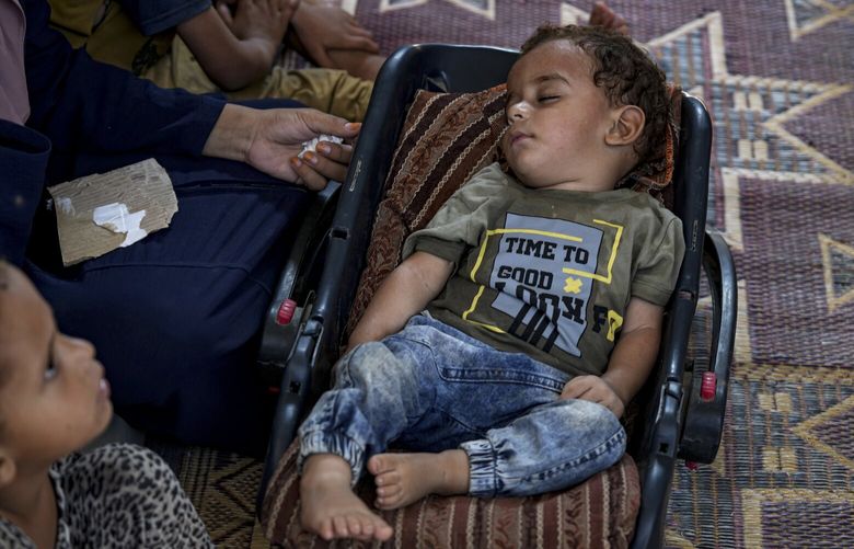 CORRECTS NAME: Displaced infant Abdel-Rahman Abu El-Jedian, who suffers from polio, sleeps at a makeshift tent camp in Deir al-Balah, central Gaza Strip, Tuesday, Aug. 27, 2024. (AP Photo/Abdel Kareem Hana) FS502 FS502