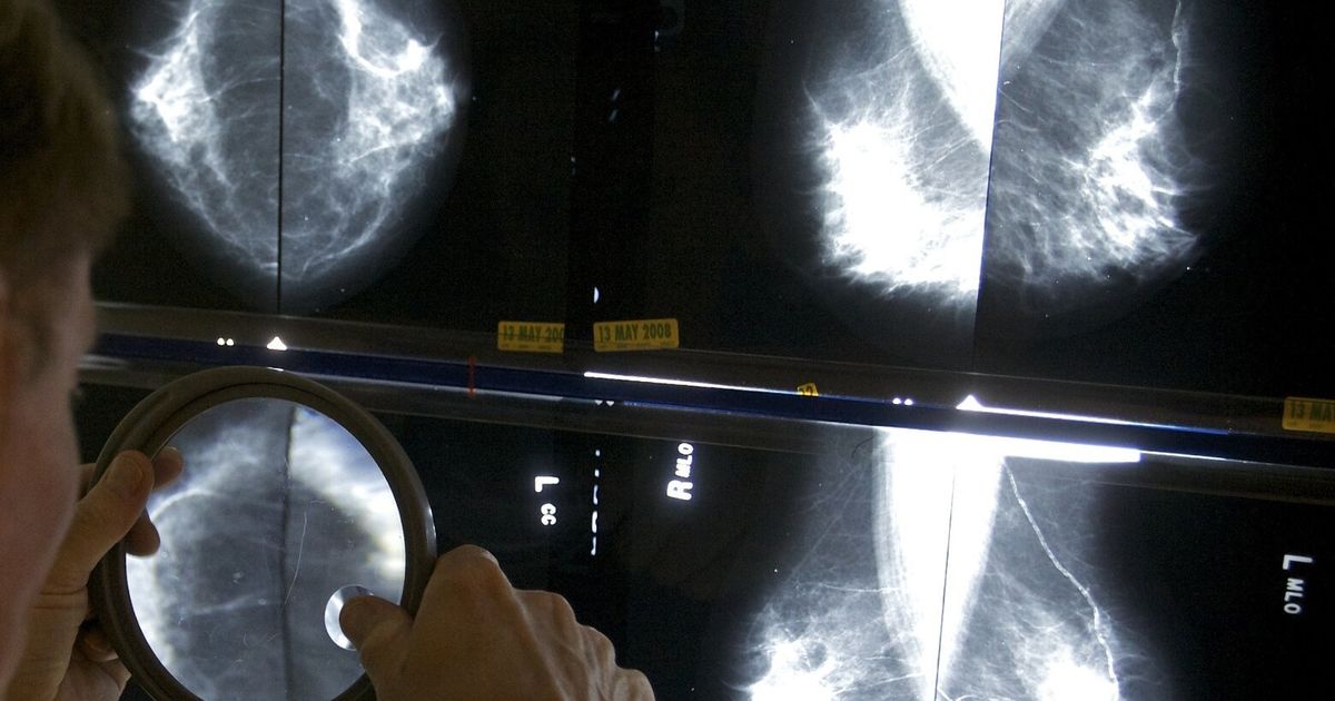 Six avoidable factors that increase your risk of breast cancer - The Seattle Times