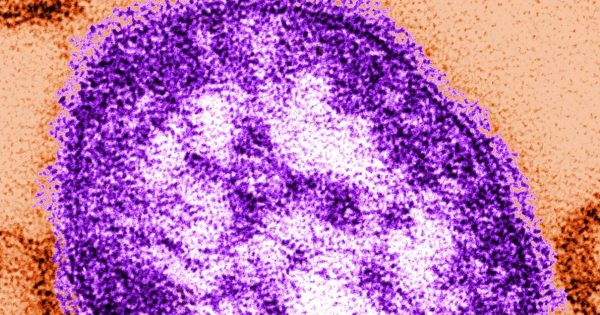 King County confirms measles case; public warned of possible exposure ...