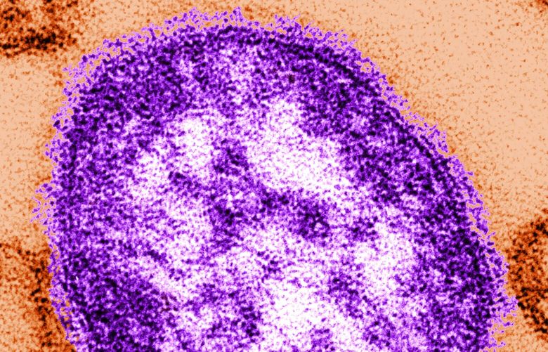 This undated image made available by the Centers for Disease Control and Prevention on Feb. 4, 2015 shows an electron microscope image of a measles virus particle, center. Measles is considered one of the most infectious diseases known. The virus is spread through the air when someone infected coughs or sneezes. (AP Photo/Centers for Disease Control and Prevention, Cynthia Goldsmith) NYPS350