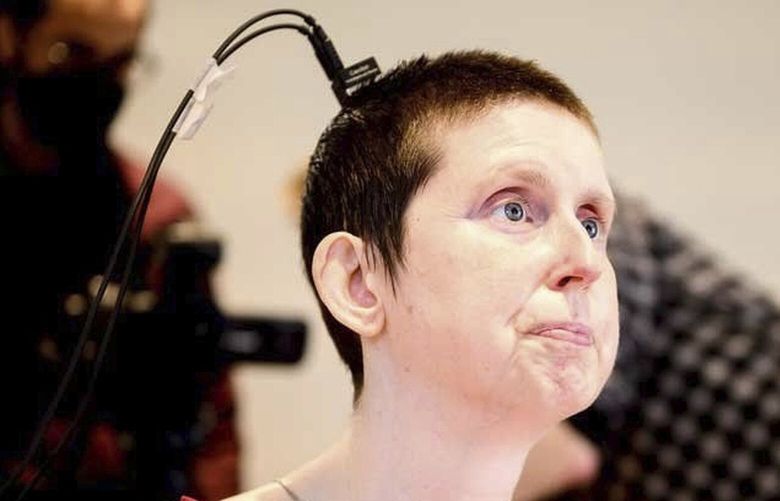 This photo provided by researchers at UCSF and UC Berkeley shows Ann, a participant in a study on speech neuroprostheses, in California in 2023. (Noah Berger/UCSF, UC Berkeley via AP) NY674 NY674