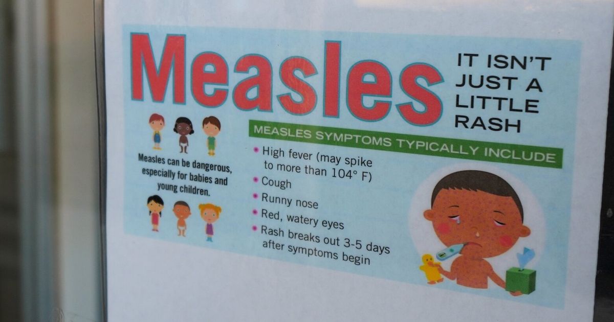 4 WA measles cases leave health officials racing to quell outbreak