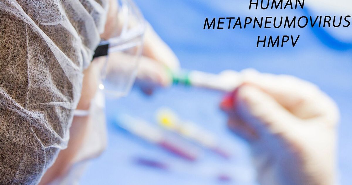 A virus without a vaccine or treatment is hitting California. What you need to know