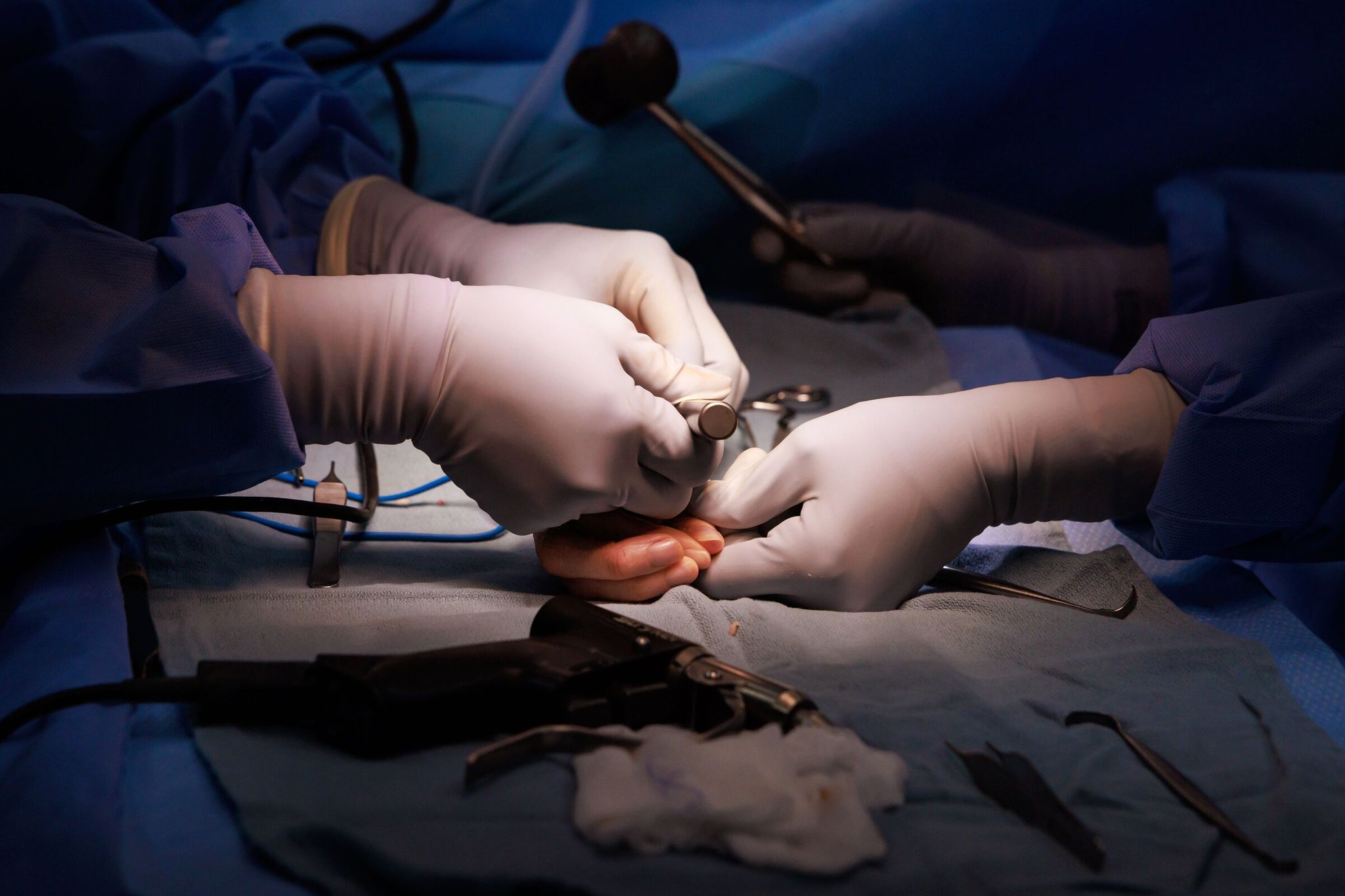 Dr. Brynn Hathaway and Dr. Jerry Huang operate on Erika Clancy’s right hand. (Erika Schultz / The Seattle Times)