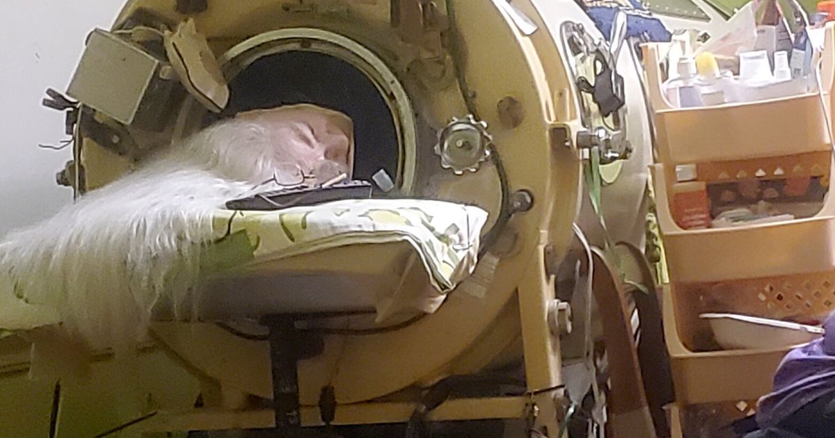 Martha Lillard, last U.S. polio patient using iron lung, dies at 78 in Oklahoma