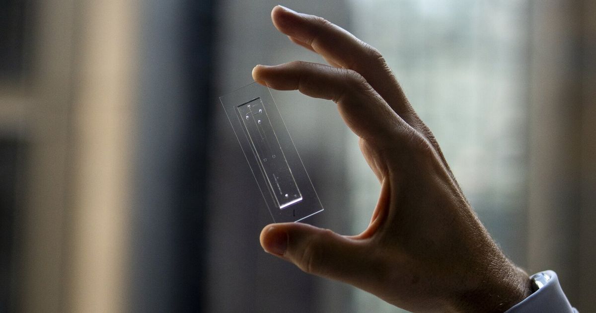 AI is finding sperm where doctors couldn’t