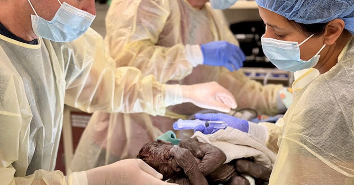 How Seattle medical providers delivered a baby gorilla by C-section