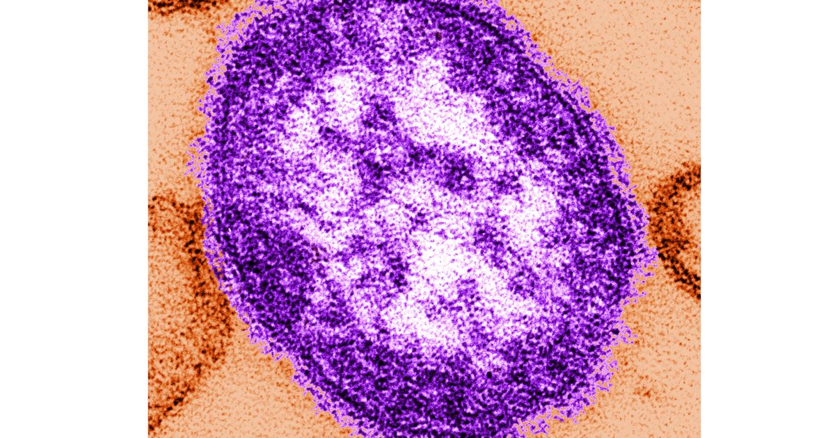 Coroner releases details of infants who died amid growing Pennsylvania measles outbreak