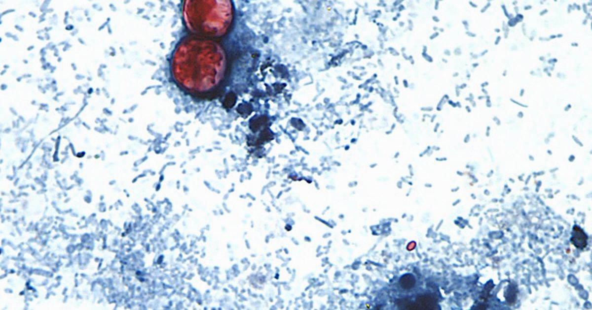 US officials tie cyclospora outbreak involving iceberg lettuce to 3 more states