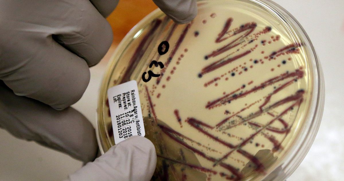 Alfalfa sprouts linked to food poisoning illnesses in Minnesota and Wisconsin