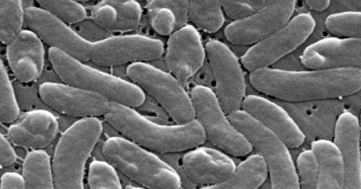 Louisiana warns against flesh-eating bacteria after five deaths - image 1