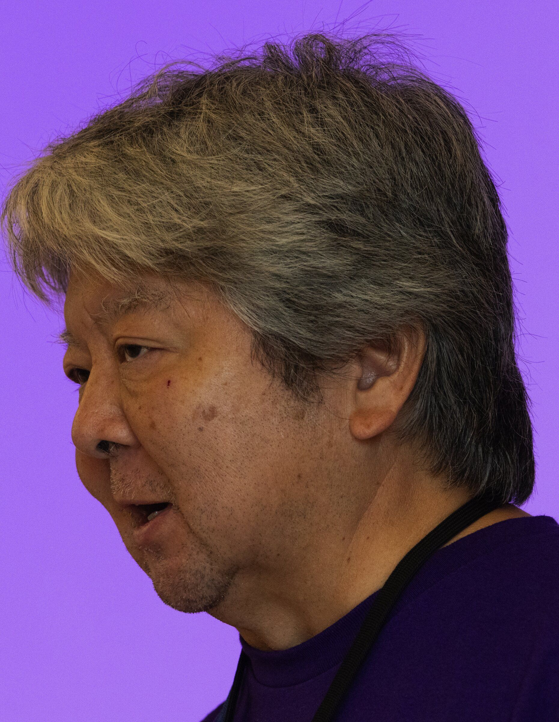 Dr. Ryutaro Hirose, head of UW Medicine’s transplant surgery division, speaks at the “transplant picnic” held Sunday on the University of Washington campus in Seattle. (Ken Lambert / The Seattle Times)