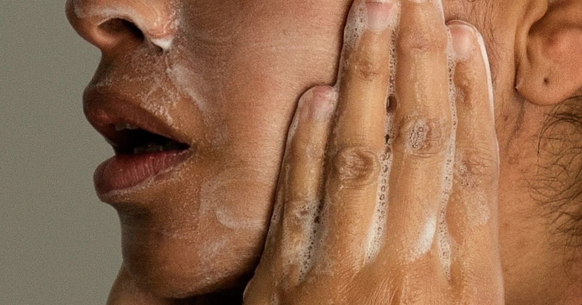 Adult acne is real, but there are ways to treat it. Here’s what to know