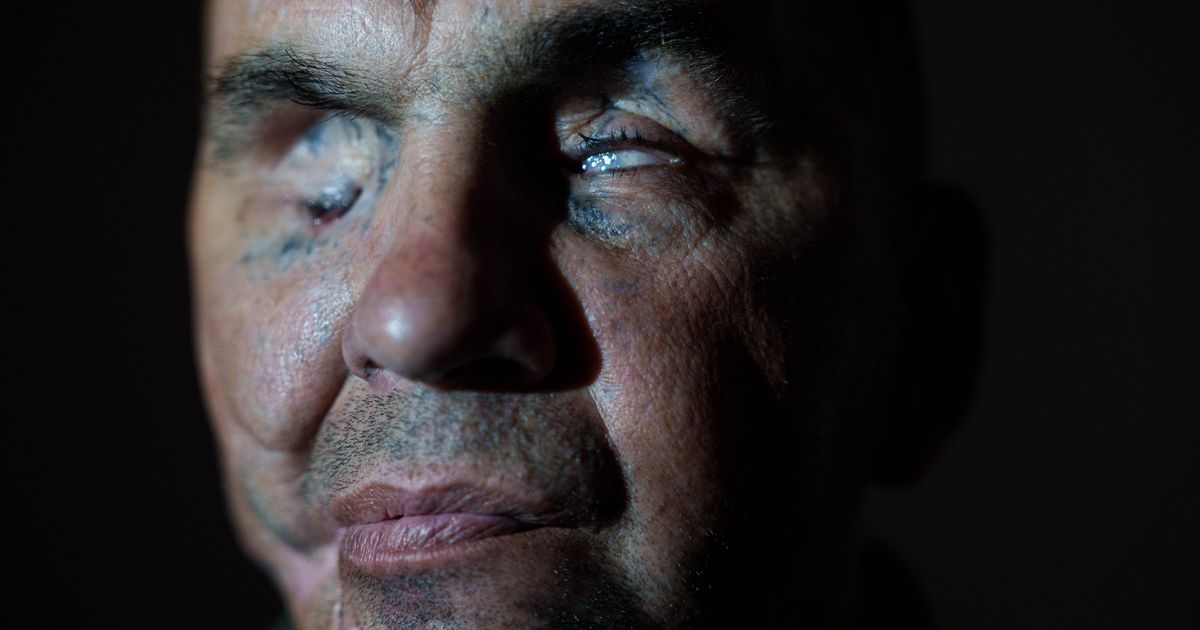 A Ukrainian soldier lost his sight in war. Now he hopes to see his children again